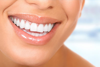Photo of beautiful smile with tooth veneers