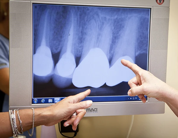 Photo of dentist team looking at patients tooth xrays